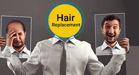advantages of the procedure